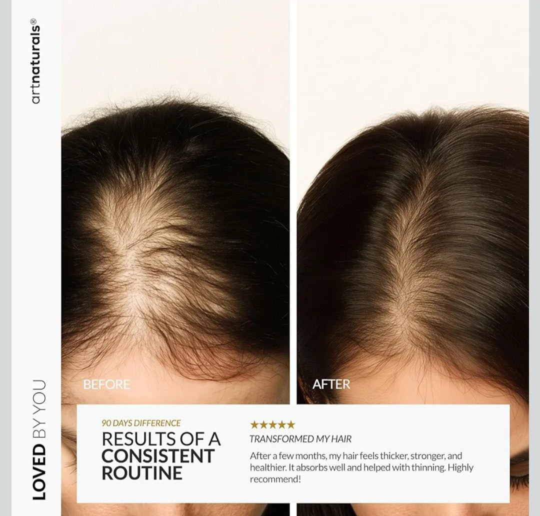 Hair regrowth oil anti-dandruff ant-hair loss hair breakage hair thickener hair soft hair regenerate hair care scalp care margarines oil